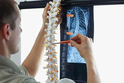 Chiropractor examining spine X-ray at Empire Chiropractic in Nyack, NY